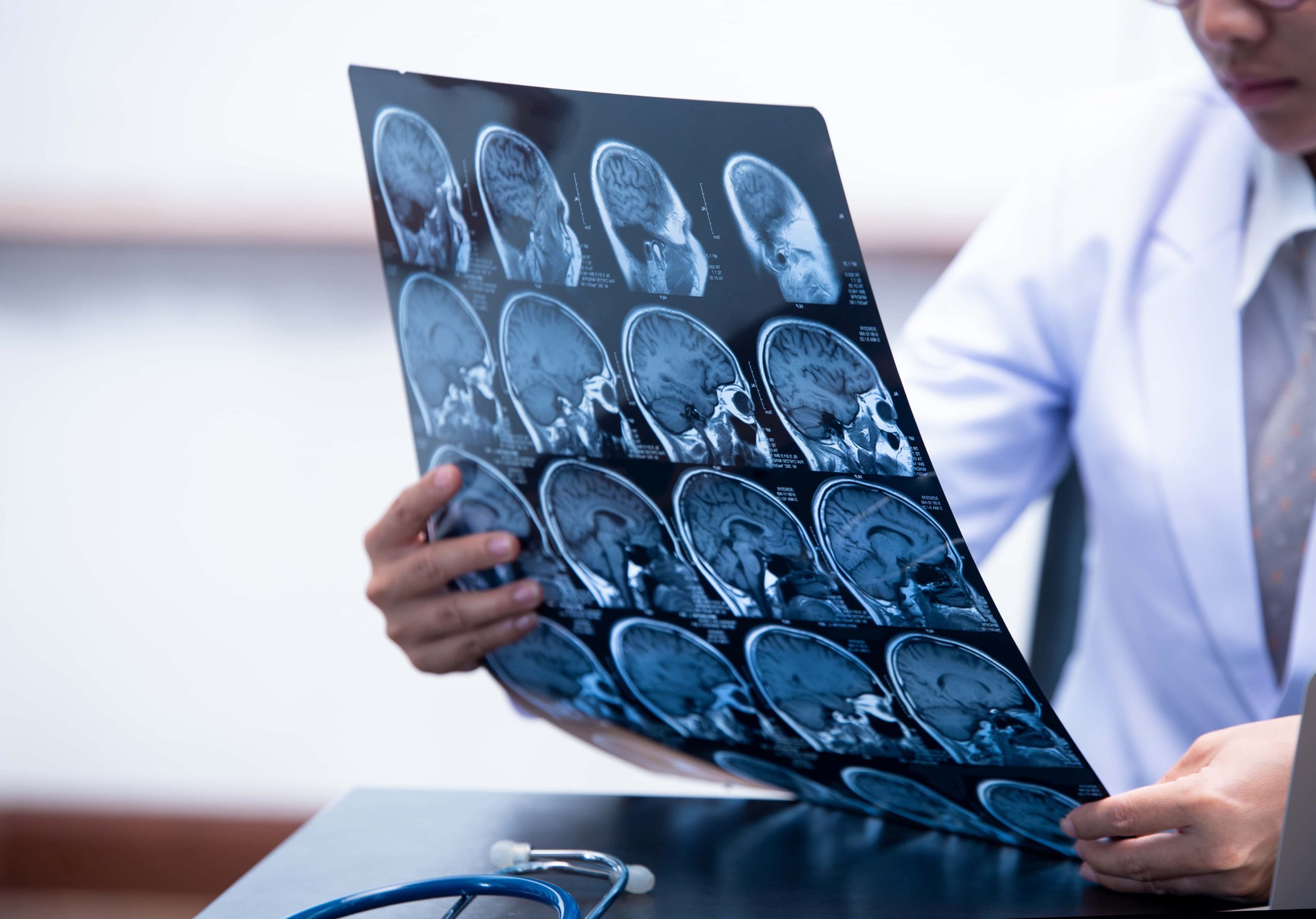 Neurologia